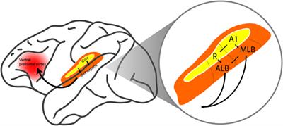 Neural mechanisms of auditory categorization: from across brain areas to within local microcircuits